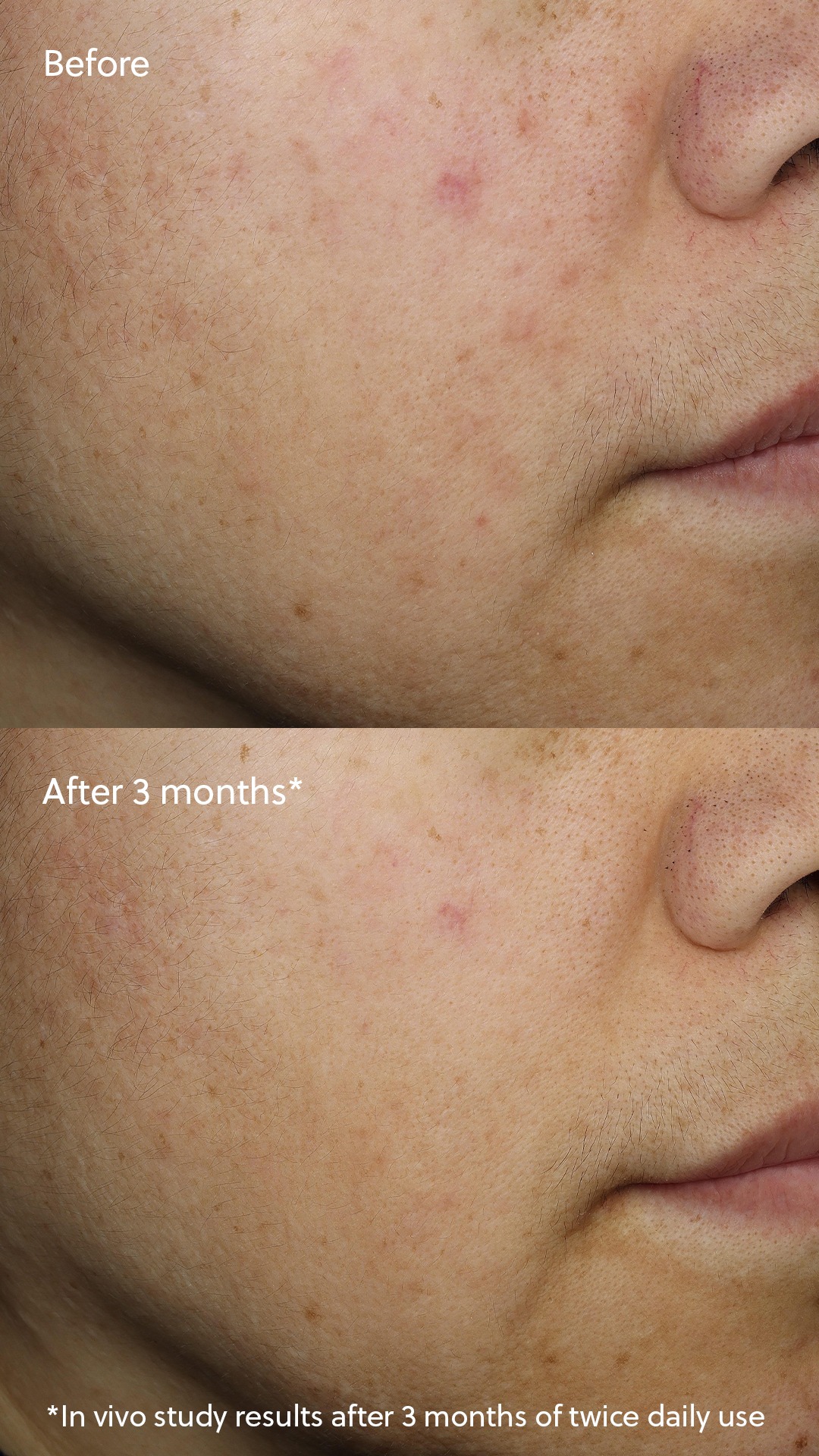 Vitamin C⁺ Serum - Afbeelding 4